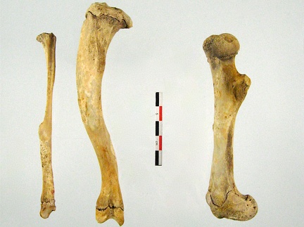 Tibia Fibula