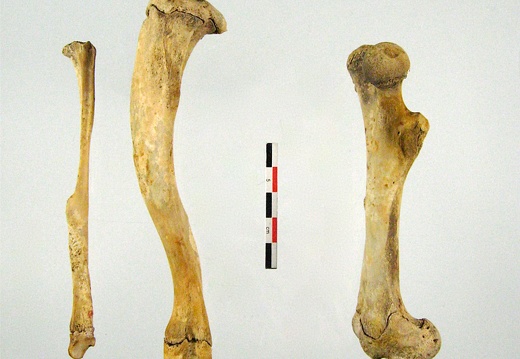 Tibia Fibula