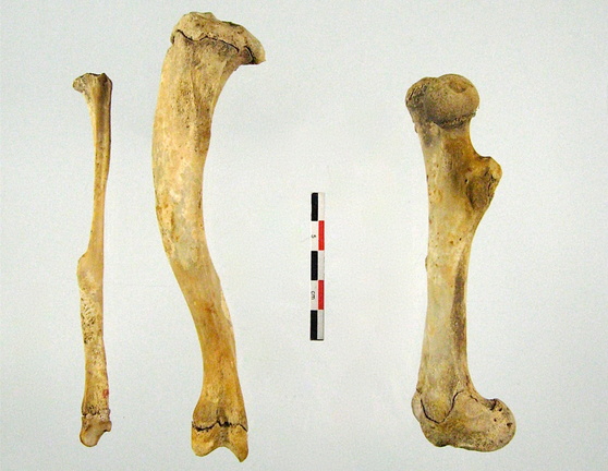 Tibia Fibula