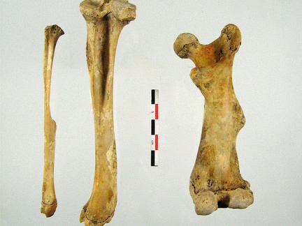 Femur anterieur