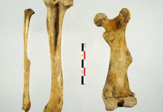 Femur anterieur