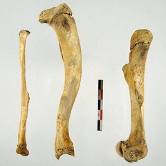 Femur Tibia Fibula mesial