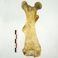 Femur Tibia Fibula posterieur (16618 visits) Femur Tibia Fibula posterieur