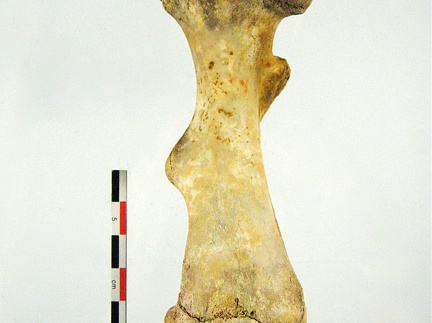 Femur Tibia Fibula posterieur