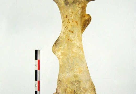 Femur Tibia Fibula posterieur