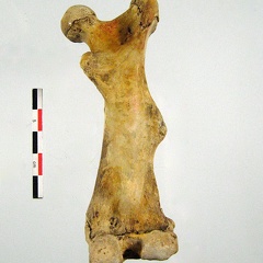 Tibia Fibula lateral 01 (14302 visites) Tibia Fibula lateral 01