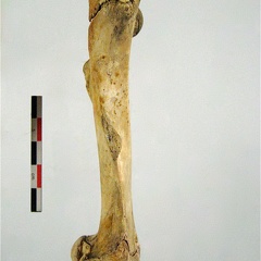 Femur posterieur