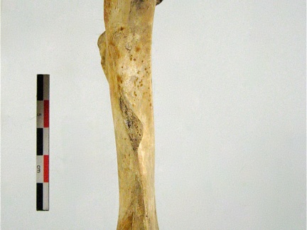 Femur posterieur