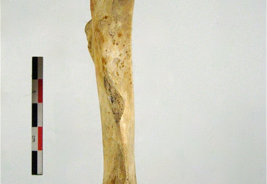 Femur posterieur