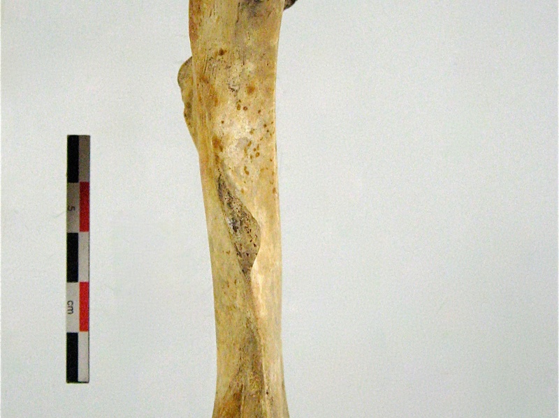 Femur posterieur (16151 visits) Femur posterieur