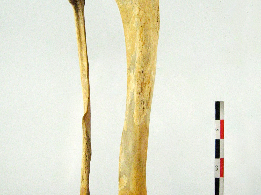 Tibia Fibula posterieur (18416 visitas) Tibia Fibula posterieur