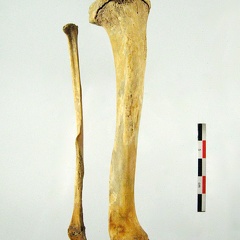 Tibia Fibula posterieur (18412 visites) Tibia Fibula posterieur
