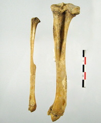 Femur Tibia Fibula lateral