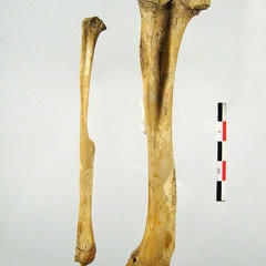 Femur Tibia Fibula lateral