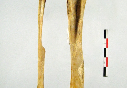 Femur Tibia Fibula lateral