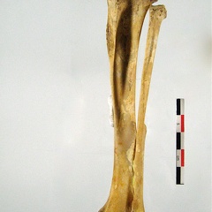 Femur lateral