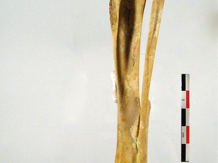 Femur lateral