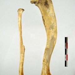 Tibia Fibula lateral 02