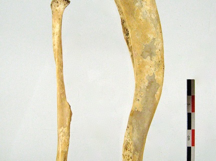 Tibia Fibula lateral 02 (14523 visites) Tibia Fibula lateral 02