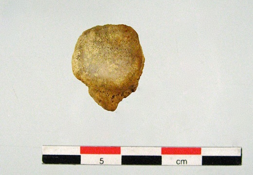 Patella posterieur (16993 visitas) Patella posterieur