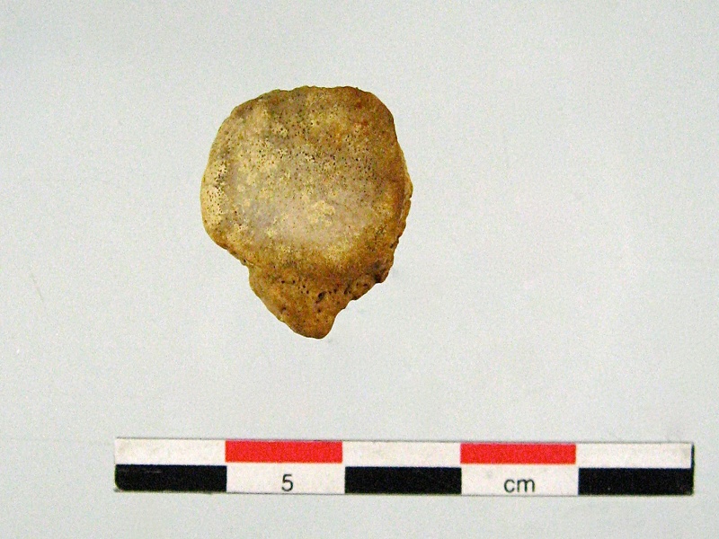 Patella posterieur (16996 visites) Patella posterieur