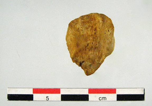 Patella anterieur