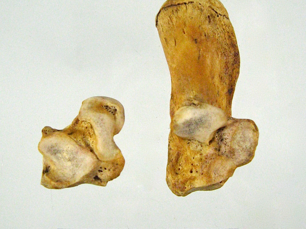 Tarses Calcaneum Talus 01 (15348 visitas) Tarses Calcaneum Talus 01