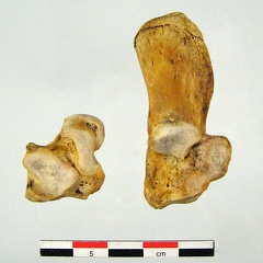 Tarses Calcaneum Talus 01