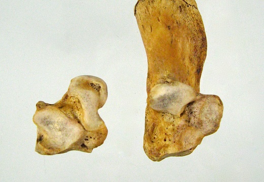 Tarses Calcaneum Talus 01 (15348 visites) Tarses Calcaneum Talus 01