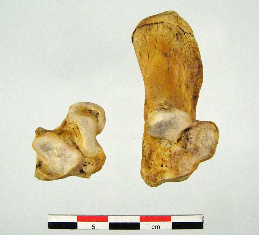 Tarses Calcaneum Talus 01