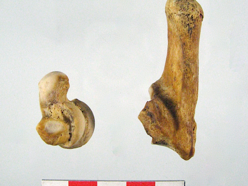 Tarses Calcaneum Talus 02 (15772 visites) Tarses Calcaneum Talus 02