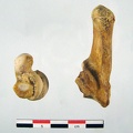 Tarses Calcaneum Talus 02 (15768 visites) Tarses Calcaneum Talus 02