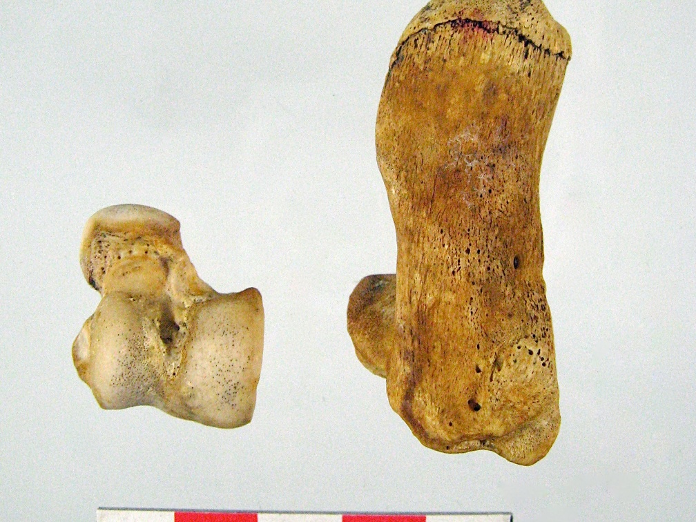Tarses Calcaneum Talus 03 (14837 visites) Tarses Calcaneum Talus 03
