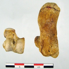 Tarses Calcaneum Talus 03 (14856 visites) Tarses Calcaneum Talus 03