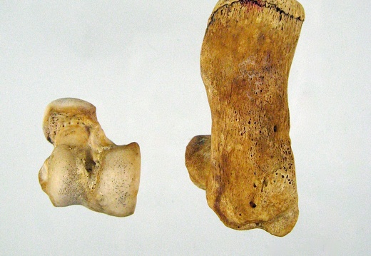 Tarses Calcaneum Talus 03 (14837 visitas) Tarses Calcaneum Talus 03
