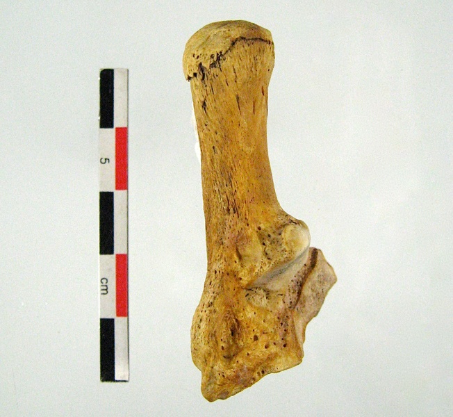 Tarse_Calcaneum.jpg