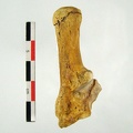 Tarse Calcaneum