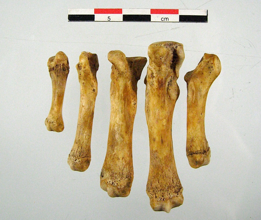 Metatarses posterieur