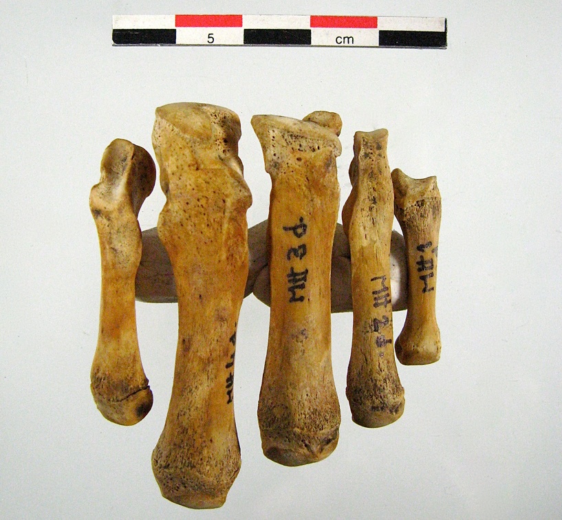 Metatarses anterieur