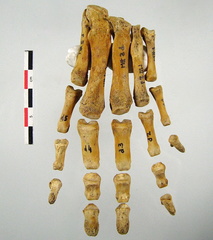 Metatarses Phalanges anterieur 01