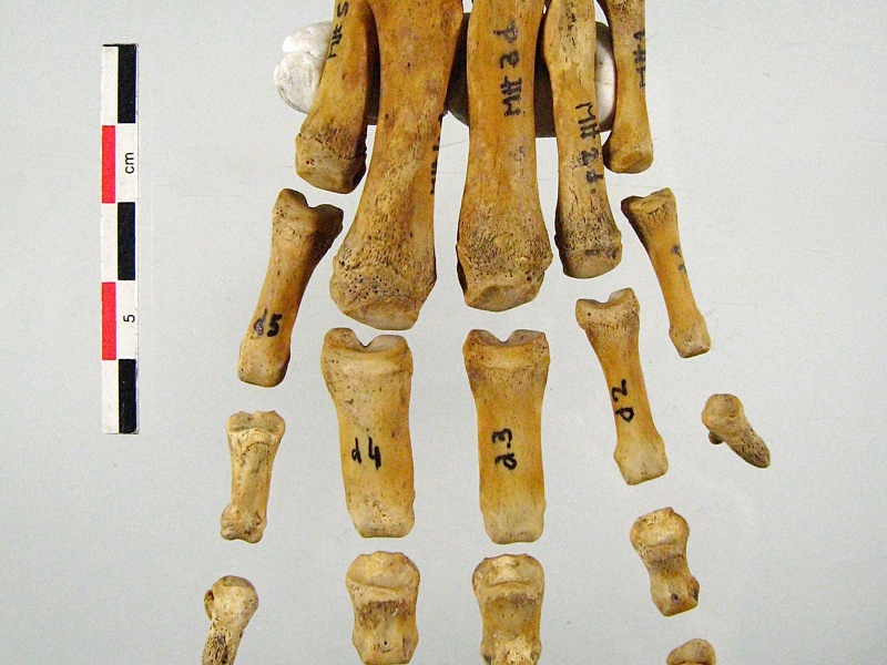 Metatarses Phalanges anterieur 01