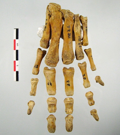 Metatarses Phalanges anterieur 01