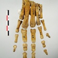 Metatarses_Phalanges_anterieur_01.jpg