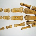 Metatarses Phalanges anterieur 02 (18287 visites) Metatarses Phalanges anterieur 02