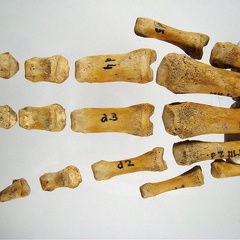 Metatarses Phalanges anterieur 02 (18278 visites) Metatarses Phalanges anterieur 02