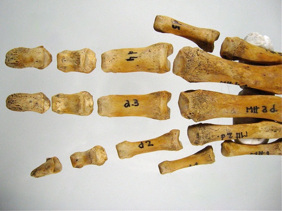 Metatarses Phalanges anterieur 02 (18237 visites) Metatarses Phalanges anterieur 02