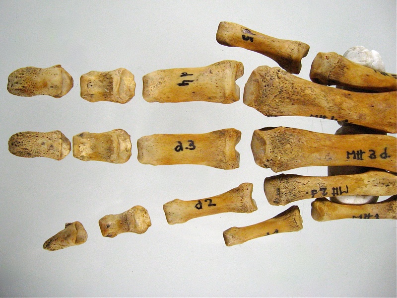 Metatarses Phalanges anterieur 02 (18244 visites) Metatarses Phalanges anterieur 02