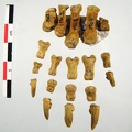 Metacarpes Phalanges G anterieur