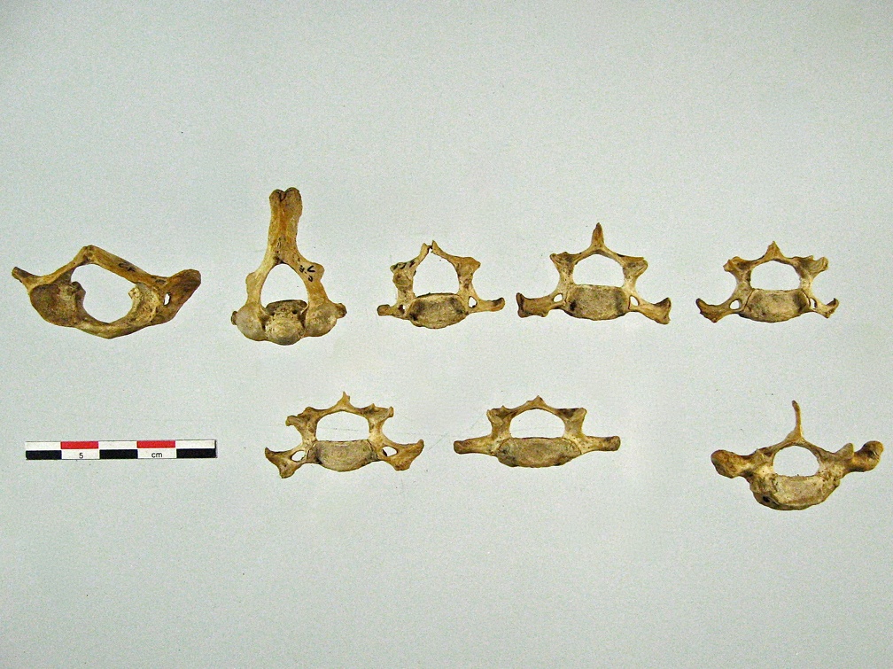 Vertebres cervicales anterieur