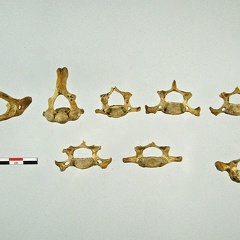 Vertebres cervicales anterieur (19557 visites) Vertebres cervicales anterieur
